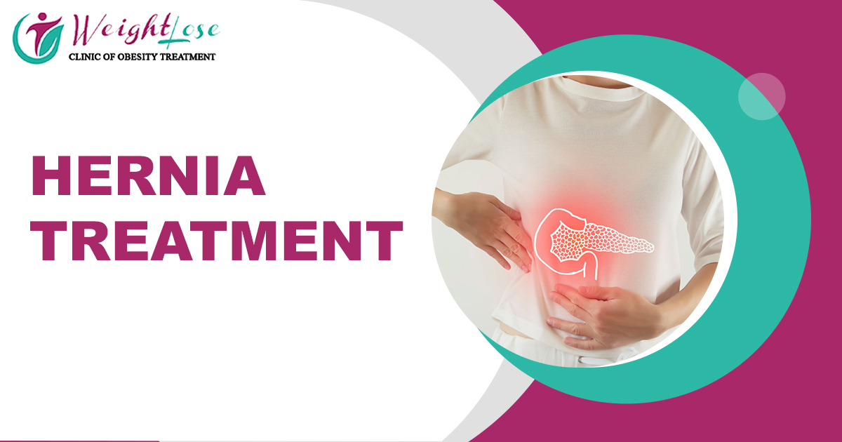 Hernia Treatment